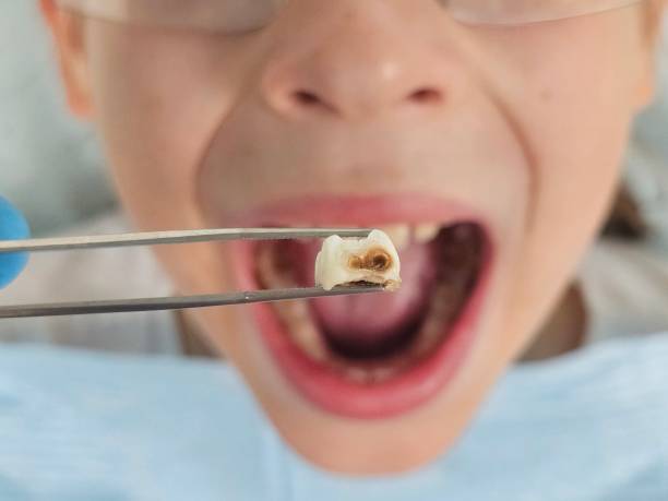 Best Emergency Orthodontic Repairs in West Mountain, UT