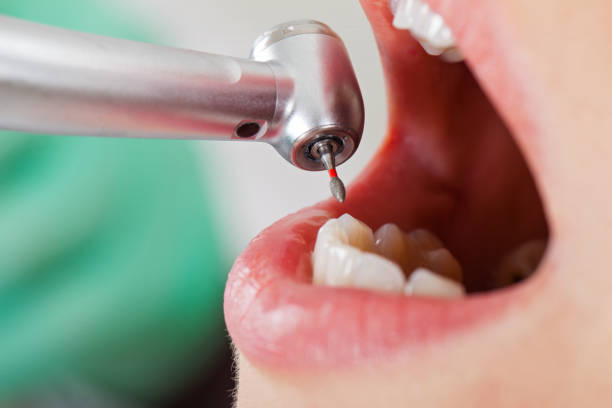 Best Emergency Dental Care for Sports Injuries in West Mountain, UT